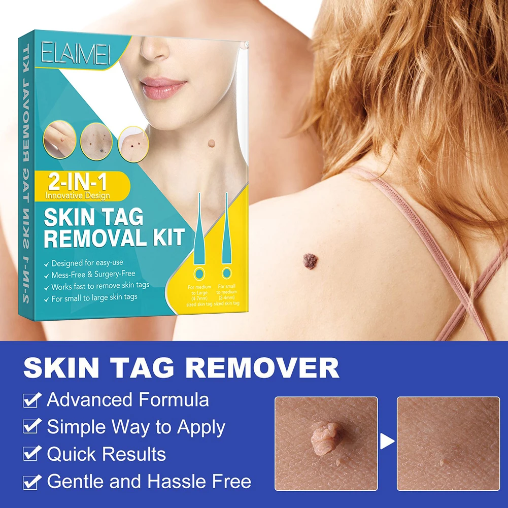 Dr Pimple Popper Skin Tag Removal Product Skin Tags Removal Products