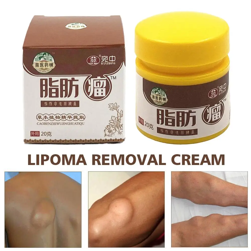 20g Lipoma Cream Subcutaneous Lumps Remover Treatment Medicine Liquid Apply To Skin Swelling Cellulite Fibroma Fat Mass Plaster