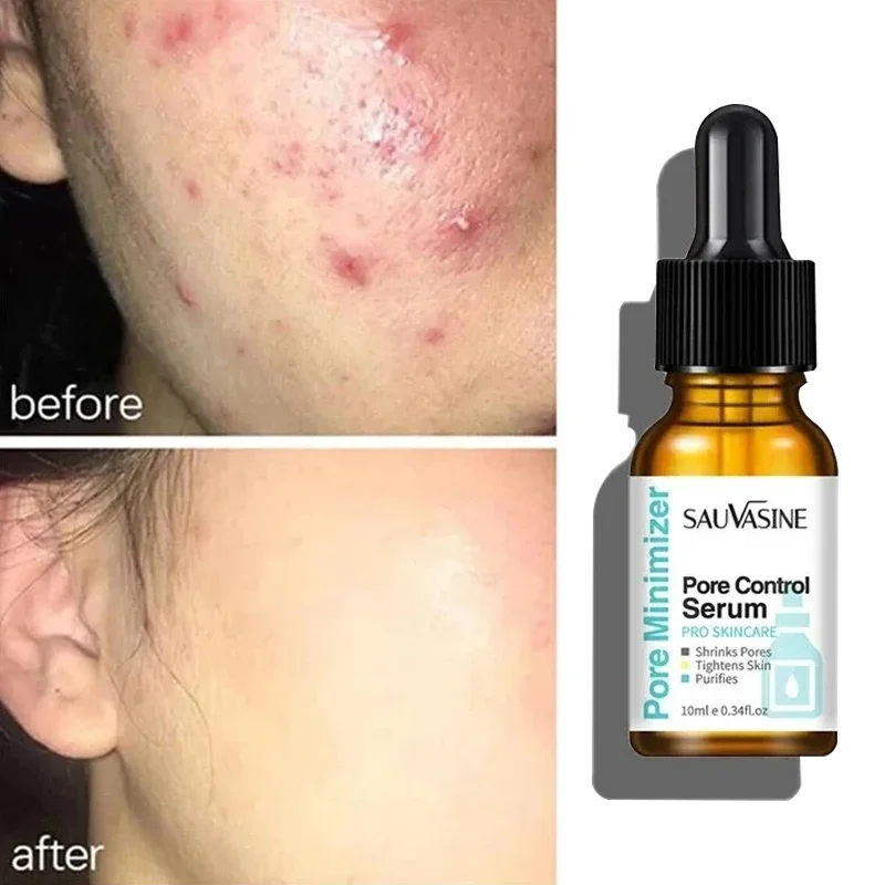 

Pore Shrinking Serum Beauty Face Removing Large Pores Tightening Repairing Facial Pore Minimizing Essence Face Care Products