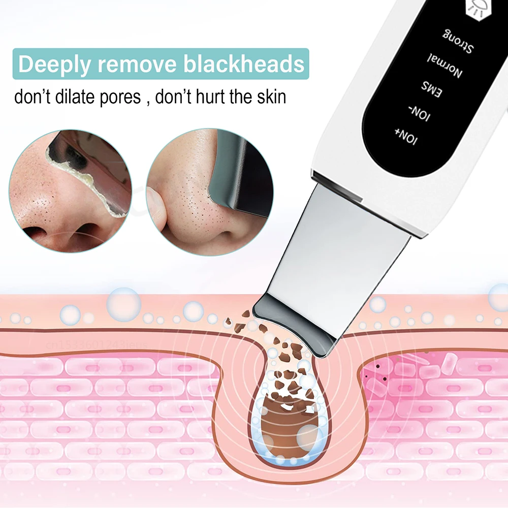 S13e8764509be4589843762be3c5280e56 Ultrasonic Skin Scrubber Peeling Blackhead Remover Deep Face Cleaning Ultrasonic Ion Ance Pore Cleaner Facial Shovel Cleanser