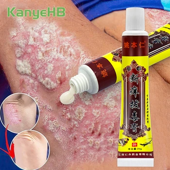 1Pcs Psoriasis Cream Anti-itch Dermatitis Eczematoid Eczema Treatment Ointment Chinese Herbal Medicine Skin Care Cream S009