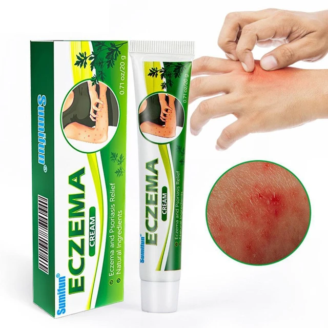 20g egzama krem çin bitkisel dermatit sedef hastalığı tedavisi merhem cilt  Anti kaşıntı sağlık alçı - AliExpress