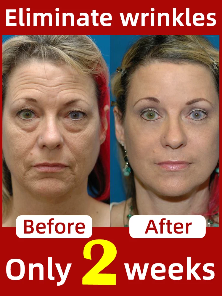 Eliminate Neck Lines face and neck cream sticks