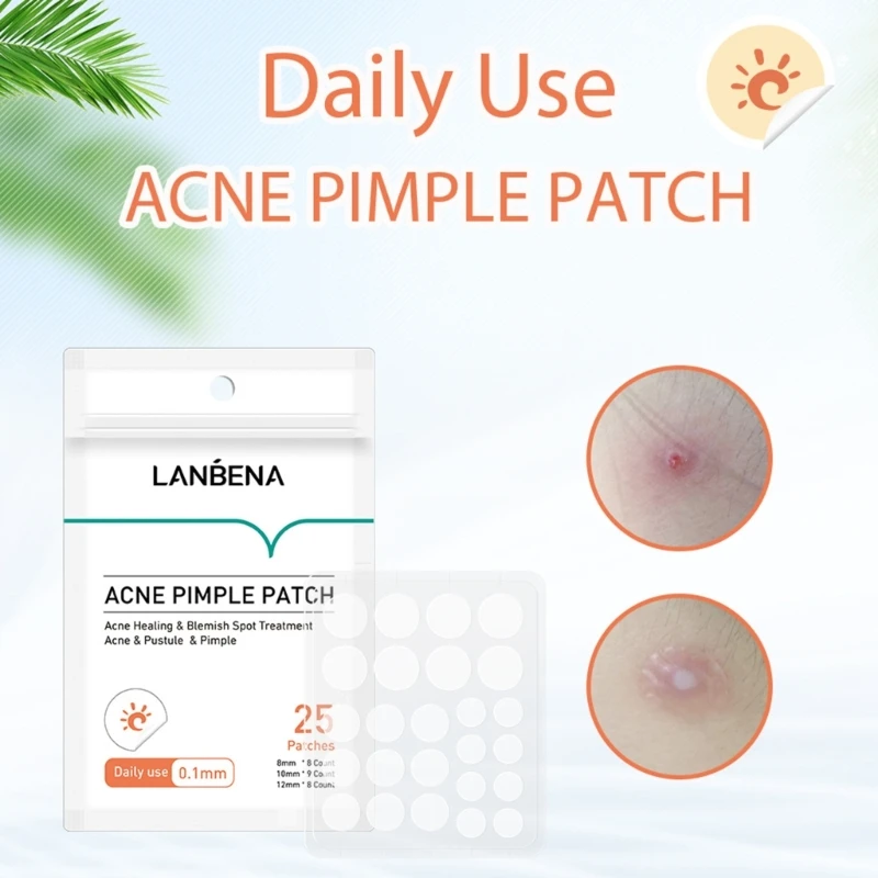 Acne stickers acne pimple patches acne removing invisible sticker remover mask patches day/night use skin care