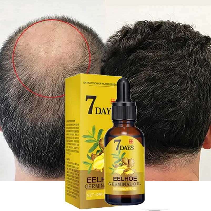 

Сыворотка Имбирная для роста волос, 7 дней, против выпадения, лечение алопеции, быстрорастущее масло для восстановления поврежденных, уход за сухими волосами для мужчин и женщин