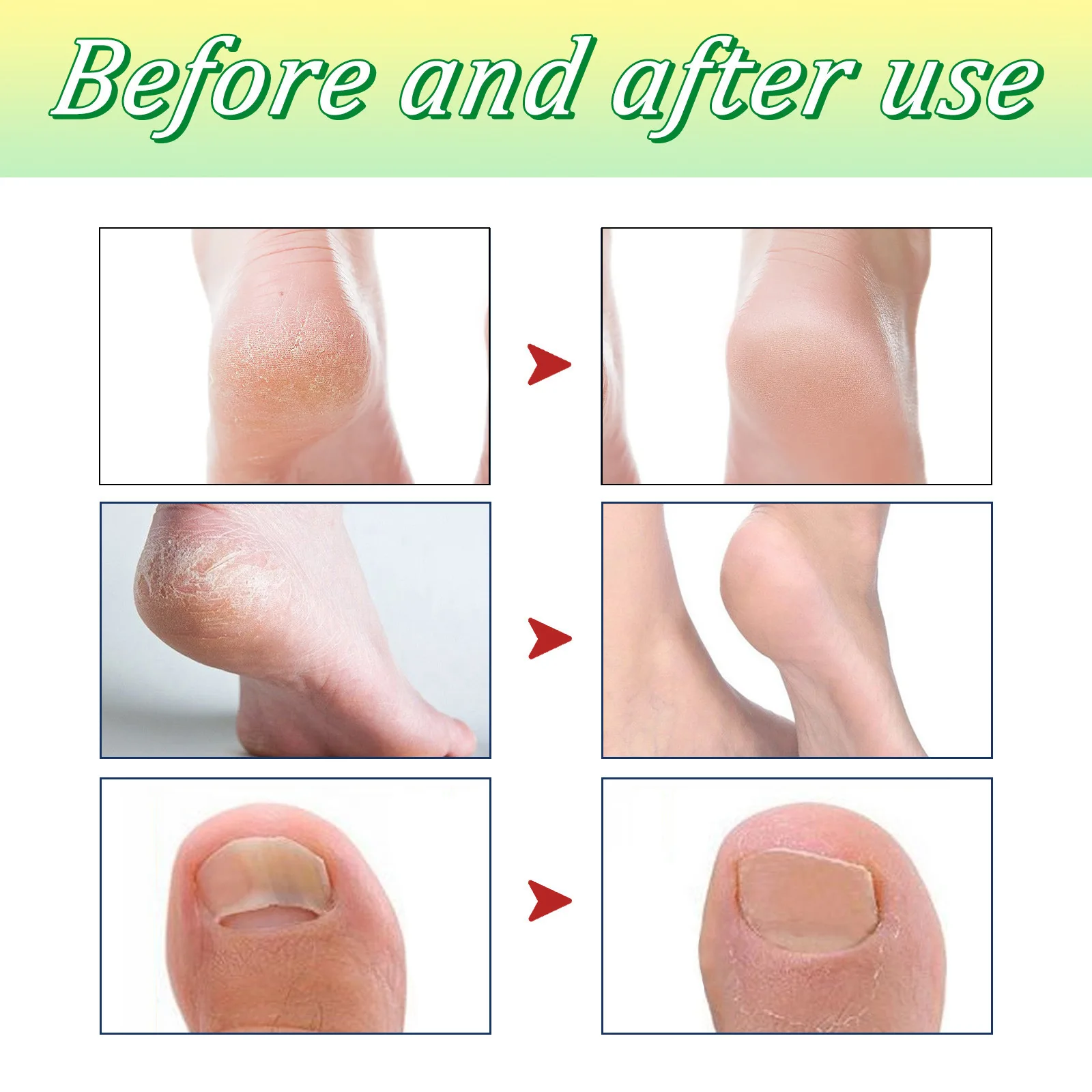 Detox Foot Soak Relieve Beriberi Promote Blood Circulation Soothing Feet Fatigue Anti Drying Cracking Herbal Foot Bath Tablet