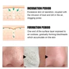 New Blackhead Remover Nose Mask Pore Strip With 60pcs Paper Deep Face Cleaning Nasal Strips Peeling Acne Treatment Skin Care 3