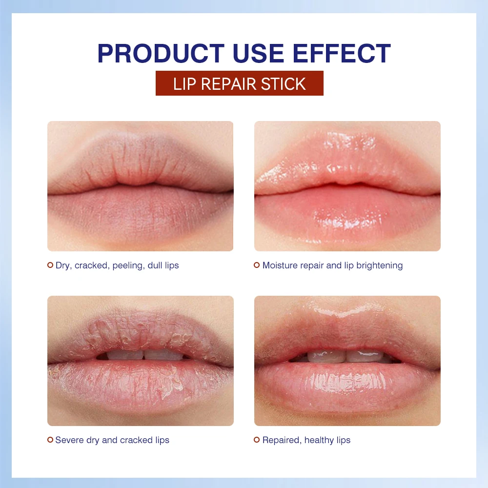 Lakerain Lip Repair Stick 2 Packs Quick Relief Of Dry Moisturizing And Smoothing lip Lines Lip Balm Soothes Chapping Lipstick 4