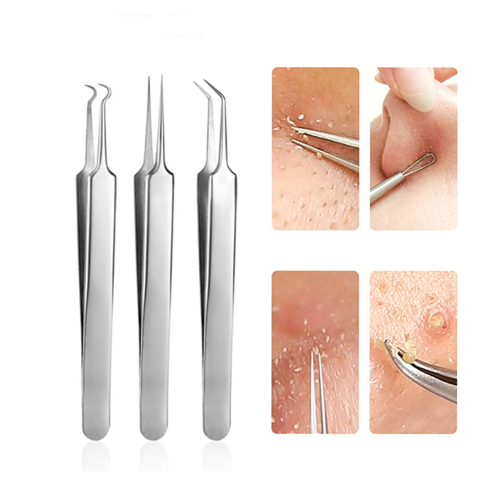 3 Pcs/lot Acne Needle Tweezers Blackhead Blemish Pimples Removal