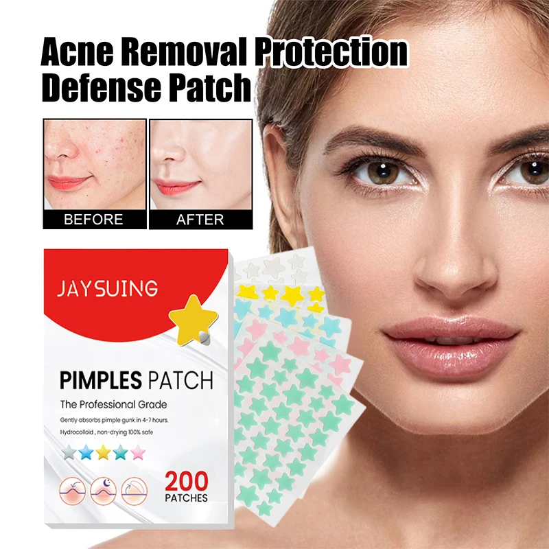 200Pcs Invisible Acne Removal Pimple Patch Beauty Acne Tool Colorful Pimple Acne Mask Concealer Face Spot Scar Care Sticker 400 200 100 50 шт 25 50 100 200pcs foot patch