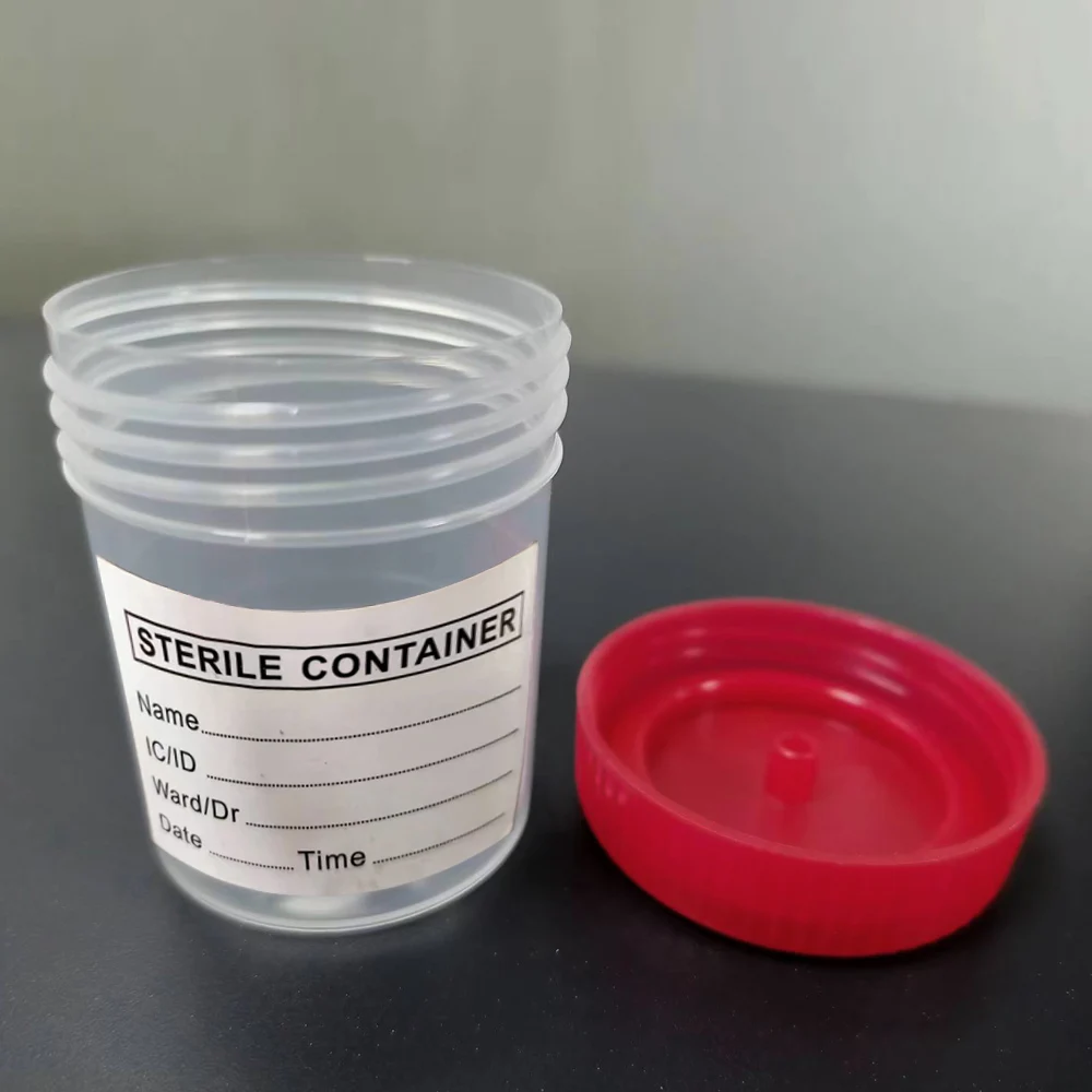 5pcs Urine Collection Sample Cup Specimen Bottle Container 60ML Plastic Cup Container for Use Disposable Urine