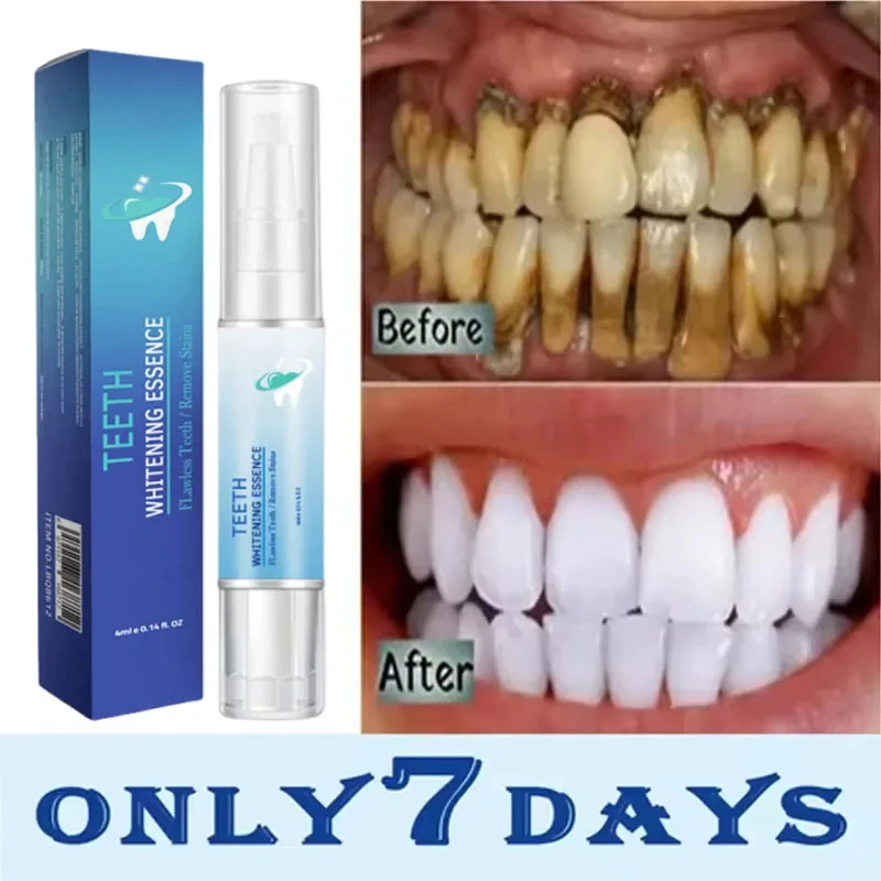 Teeth Whitening Product Teeth Whtening Toothpaste Pen Remove Plaque Stains