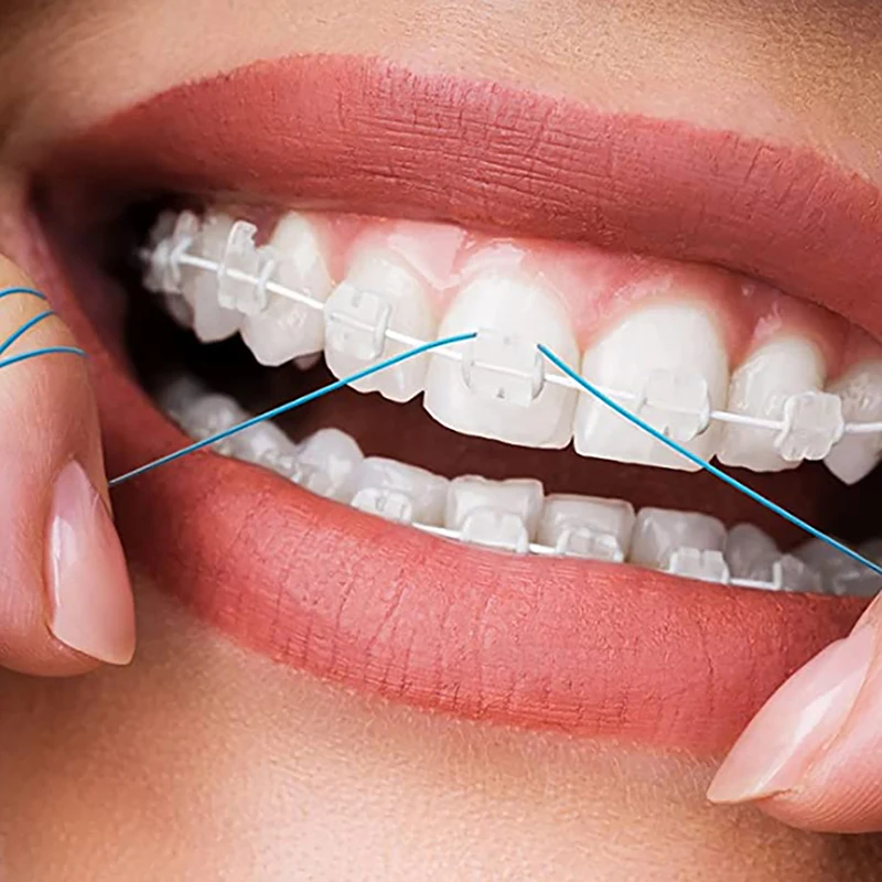 35/70pcs Fogászati Hernyóselyem threaders Cakk Hernyóselyem jogosultja Közte orthodontic Fogszabályzó Bolygótartó Izom-összehúzódás Fogszabályzó