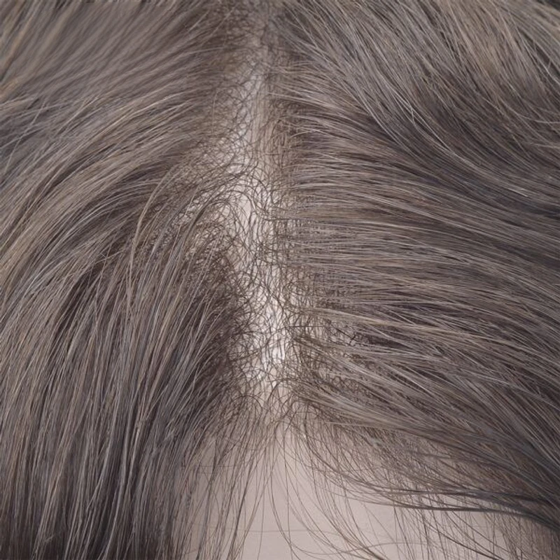 Рисунок 3 - Парик мужской с V-образной петлей