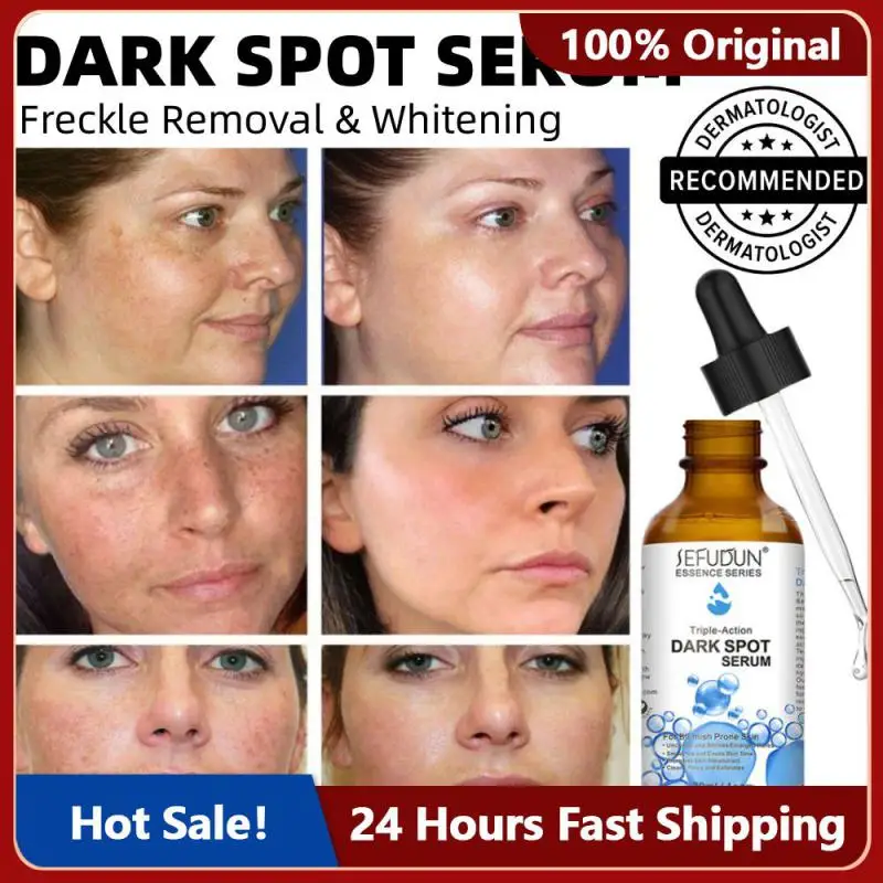 

Freckles Removal Cream Remove Facial Spots Skin Dark Spot Remove Melasma Age Spots Sunspots Whitening And Freckle Removing Cream