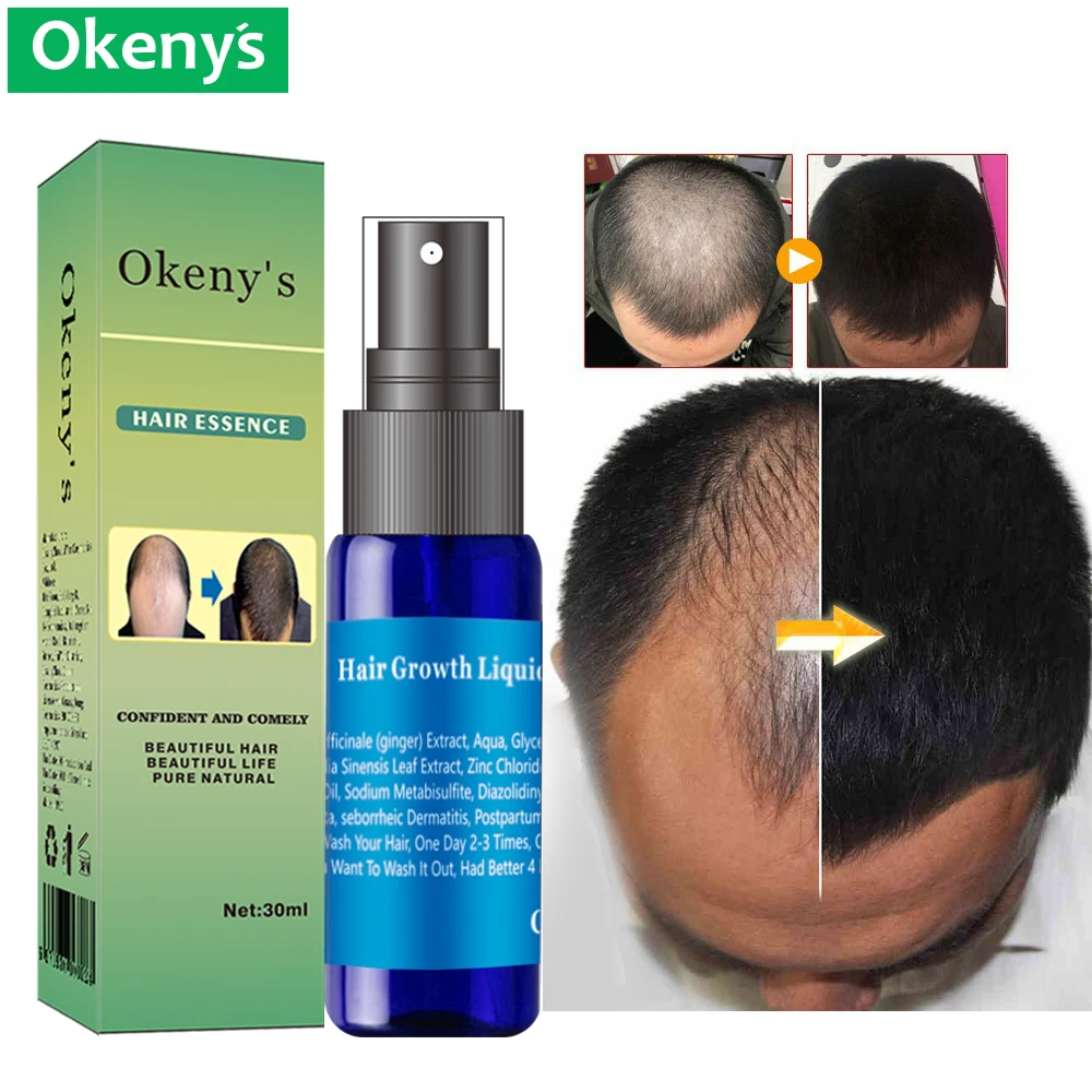 Ginger Andrea Hair Growth Essence Oil Fast Grow Dense Restoration Anti Hair Loss Product Sunburst Alopecia for Woman Man 30ml 5