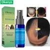 Ginger Andrea Hair Growth Essence Oil Fast Grow Dense Restoration Anti Hair Loss Product Sunburst Alopecia for Woman Man 30ml 5