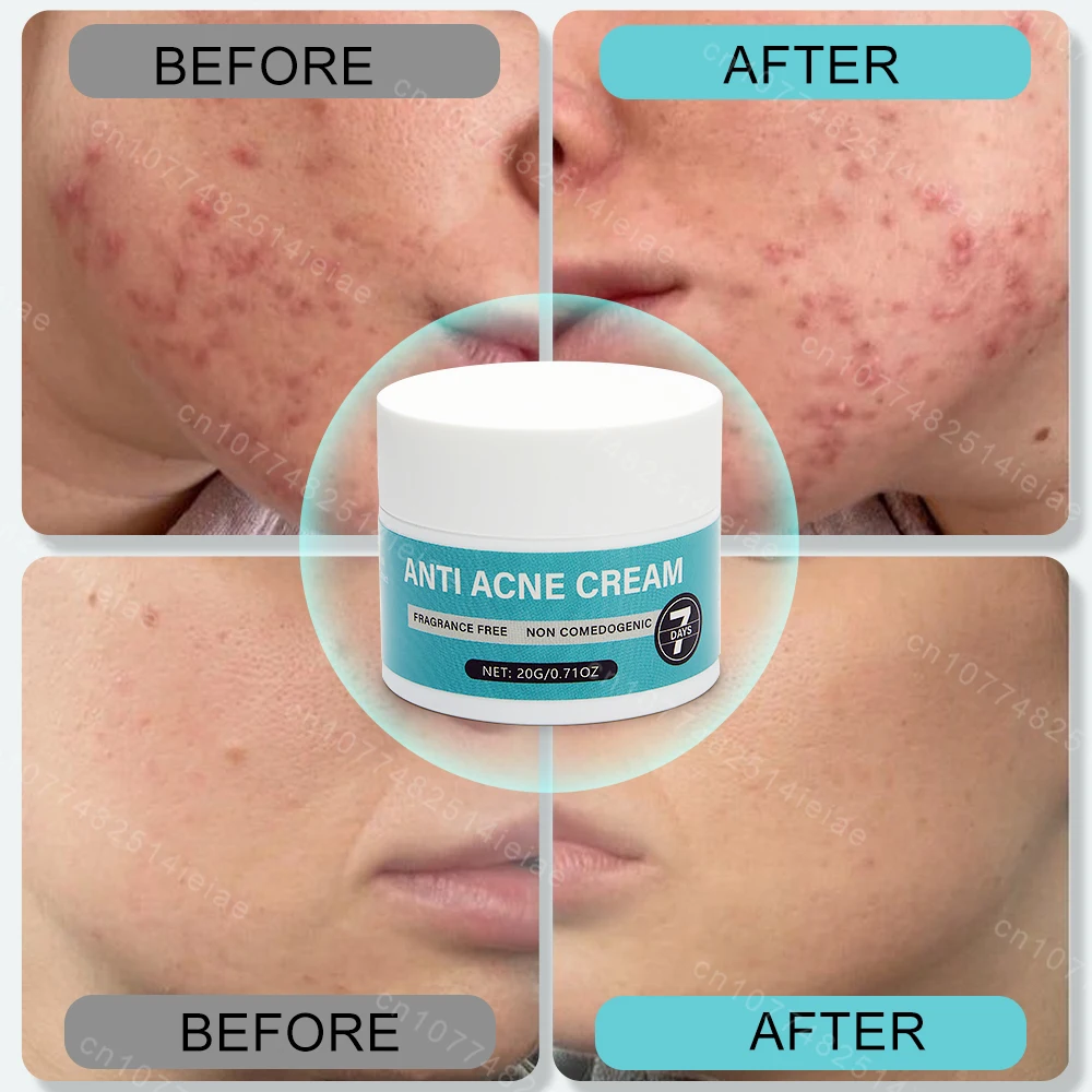 Face Cream Shrink Pores Repair