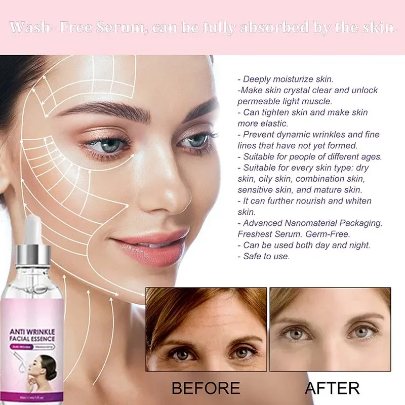 For wrinkles Radiate confidence 3