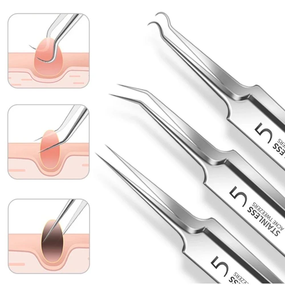 1PC/3PCS Ultra-fine No. 5 Cell Pimples Blackhead Clip Tweezers Pimple Popper Tool Kit Blackhead Remover Acne Needle Tool Set