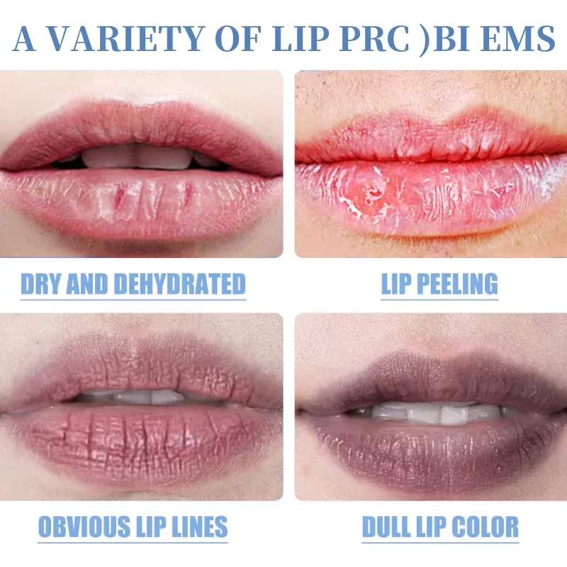 Fast Lightening Pink Mouth Lips Serum Bleaching Permanent Remove Dark Smoke Lips Lip Balm Moisturize Gloss Lipstick Lip Oil 2