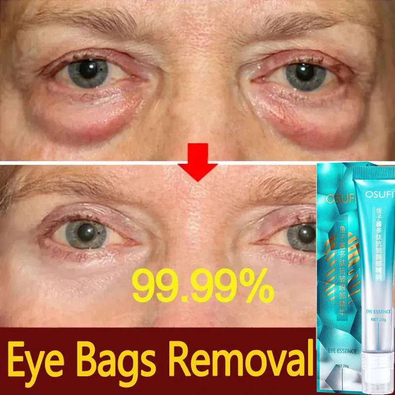 

Peptide Anti-Wrinkle Eye Cream 7 Days Remove Puffiness Under Eye Bags Whiten Dark Circle Fade Fine Line Tighten Korea Cosmetics