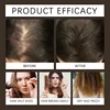 46218-6991fb.jpg Biotin Fast Hair Growth Spray Anti Hair Loss Serum Prevent Baldness Treatment Scalp Beard Beauty Essence Hair Care Products 30ml