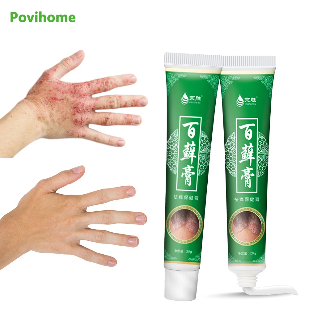 

20g Psoriasis Antibacterial Cream Dermatitis Eczematoid Ointment Effective Anti-Itch Chinese Herb Medical Health Skin Care