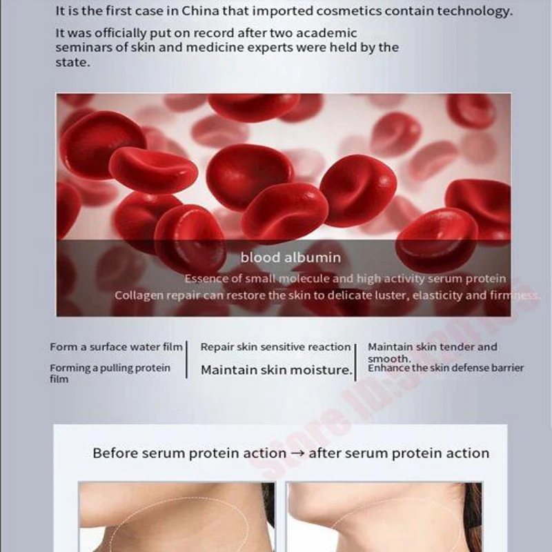 Neck Lines Hemoglobin Collagen Protein Essense Moisturis Nourish Lift Neck Eliminate Fine Lines Anti-ageing Rejuvenation