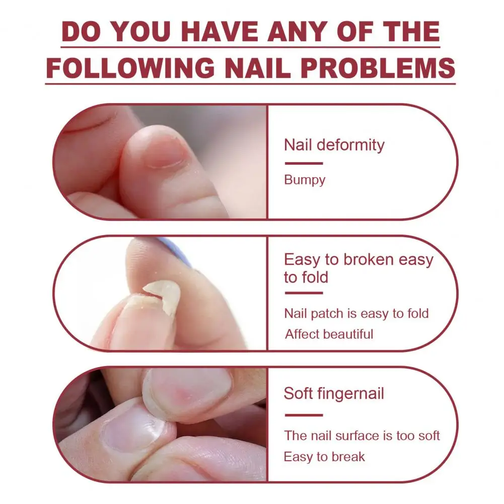 Nail Repair Gel Kit 1 Set Fashion Non-irritating Fast Dry Quick Building Phototherapy Extension Glue Nail Salon Supplies