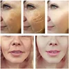 Royal Dragon Blood Serum Placenta Rejuvenation Moisturizing Smoothing Facial Firming Essence Improve Roughness Beauty Care 2