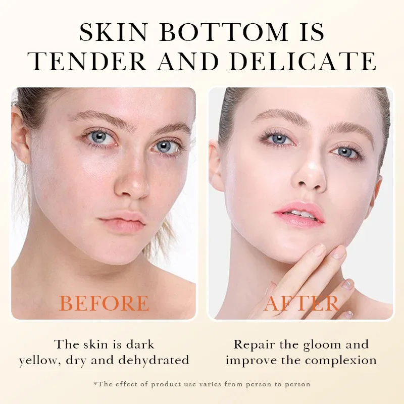 Yeast Freeze-Dried Power Facial Microneedling Serum Skin Care Set Shrink Pores Moisturizing Brighten Anti Aging Peptides Essence 4