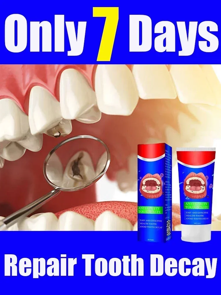 

Anti Decay Toothpaste Teeth Whitening Anti-Cavity Bad Breath Repair Tooth Decay Remove Plaque Toothache Relieve Periodontitis