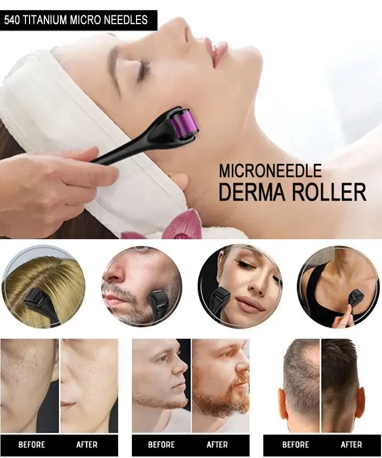 540 Derma Roller Medical Grade Skin Care Microneedling for Skin Rejuvenation and Hair Growth