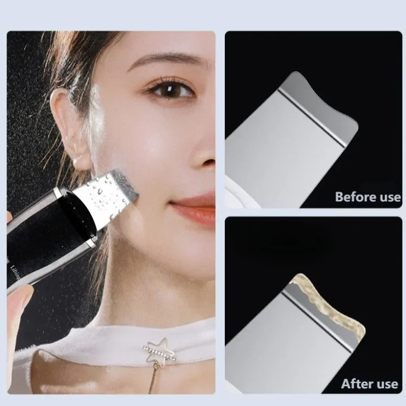 Blackhead Remover Blackhead Cleaning Pore Shrinking Beauty Device Dead Skin Acne Scalper Facial Pore Cleanser Beauty Equipment