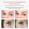 Eye and Face Lifting EMS Beauty Device 2 in 1 New RF Wrinkle Removing Eyelid Massager Skin Care Skin Rejuvenation Anti-Ageing 2