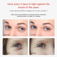 Eye and Face Lifting EMS Beauty Device 2 in 1 New RF Wrinkle Removing Eyelid Massager Skin Care Skin Rejuvenation Anti-Ageing 2