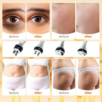 4IN1 40K Cavitation Radio Frequency Ultrasonic Slimming Machine Wrinkle Removal Weight Loss Skin Tightening Facial Beauty Tool 5