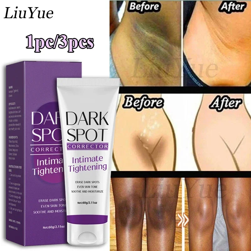 Quickly Private Parts Whitening Cream Dark Skin Underarm Brightening Cream Inner Thighs Elbows Bleach Joint Remove Melanin Cream