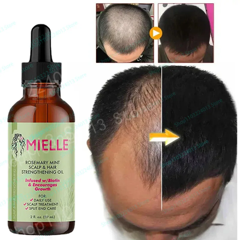 

Hair Growth Essential Oil Rosemary Mint Strengthening Oil Nourishing Treatment Reduce Split Ends and Dry Mielle Organics Hair