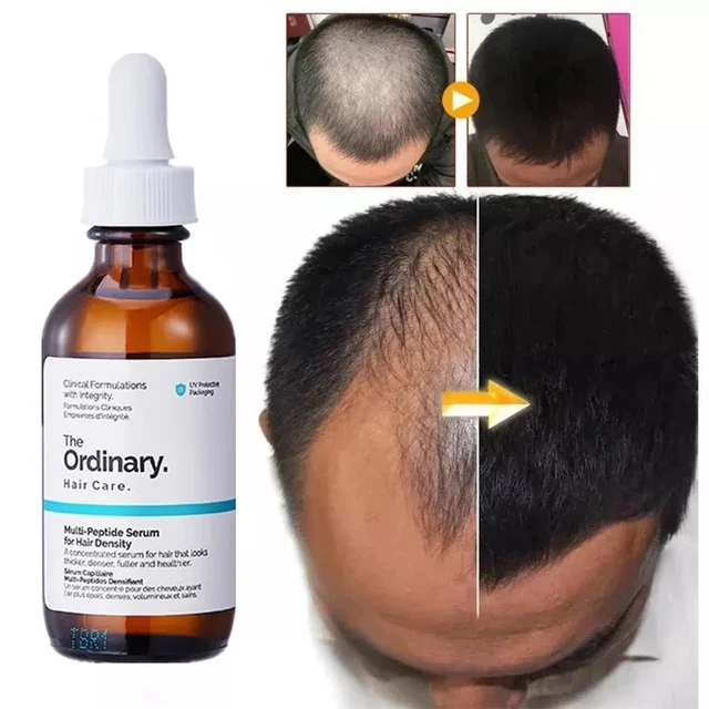 Hair Growth Serum 60ml Ordinary Original Authentic Hai Growth Essential Oils Care Essence Hair Loss Liquid Peptide Treatment 4