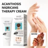 Black Acanthoderma Moisturizing Repair Cream Brightening Armpits Arms Knees Lightening Emulsion Brighten Skin Body Care Cream 1