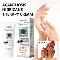 Black Acanthoderma Moisturizing Repair Cream Brightening Armpits Arms Knees Lightening Emulsion Brighten Skin Body Care Cream 1