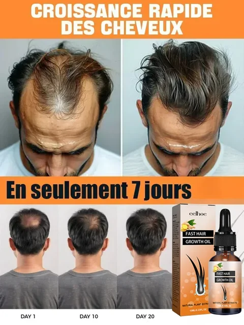 7 Repair Damaged Hair Moisturizing Smooth Oil Natural Hair Growth Oil Efficient Hair Loss Nourishing Essential Oil For Dense