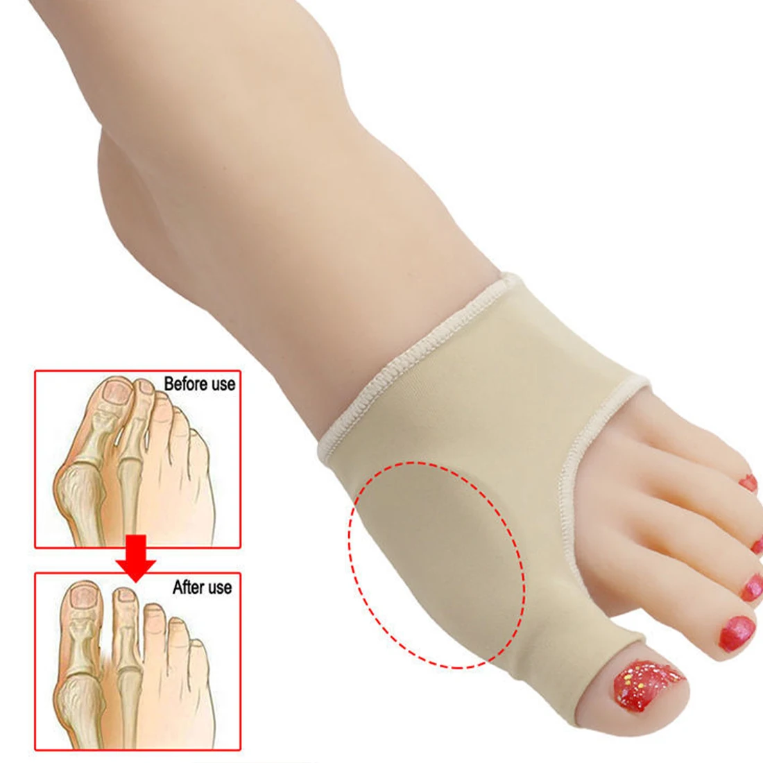 

Toe Correction Tool Hallux Valgus Bunion Corrector Foot Correction Thumb Valgus Correction Adjuster Feet Straightener