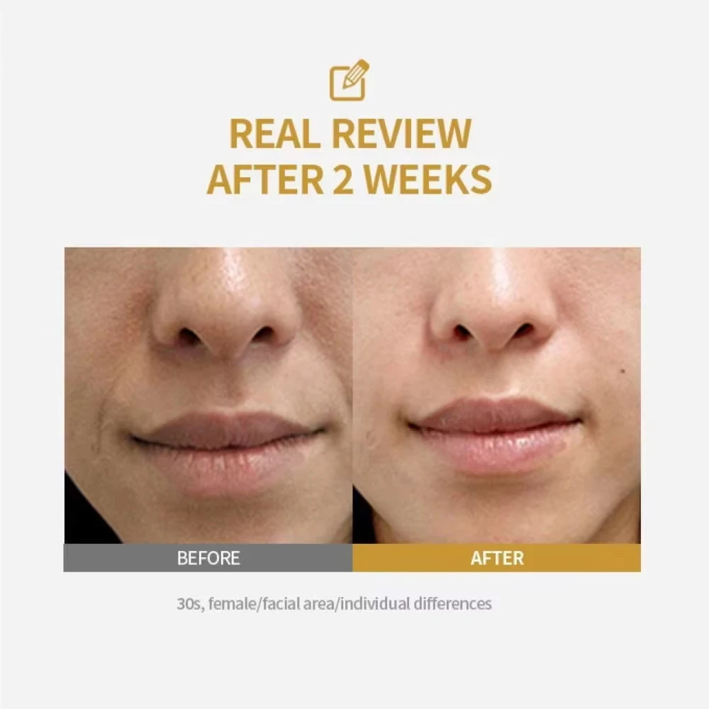 Seidenpeptid Intensiv-Lifting-Ampulle Tiefenwirksames Kollagen-Revitalisierungs-Essenz Gesichtsstraffendes Glättendes Anti-Aging-Serum S14F94C7C68A54938B9F7B8Fabc6A1Aeco