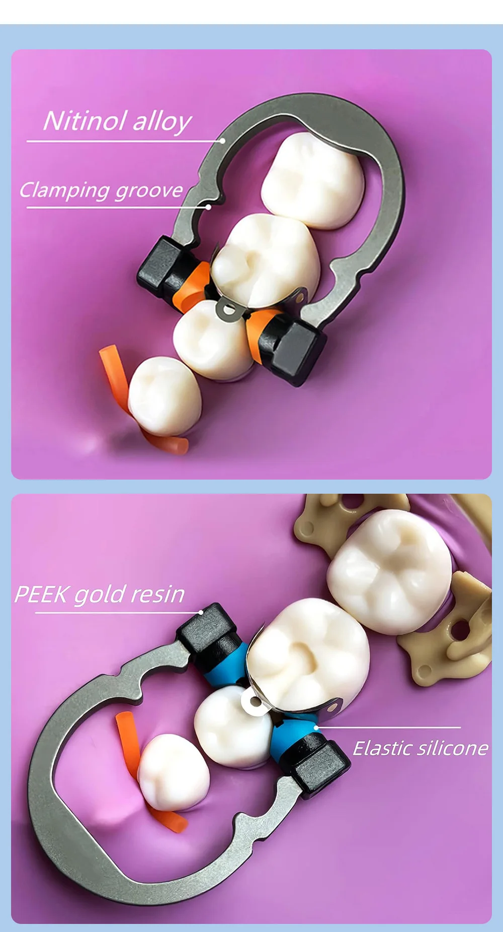 AZDENT Dental Sectional Matrix System Set New Contoured Matrices Clip Ring Bands Wedge Knife Dentis Wedges Plastic Kit_voghion.com