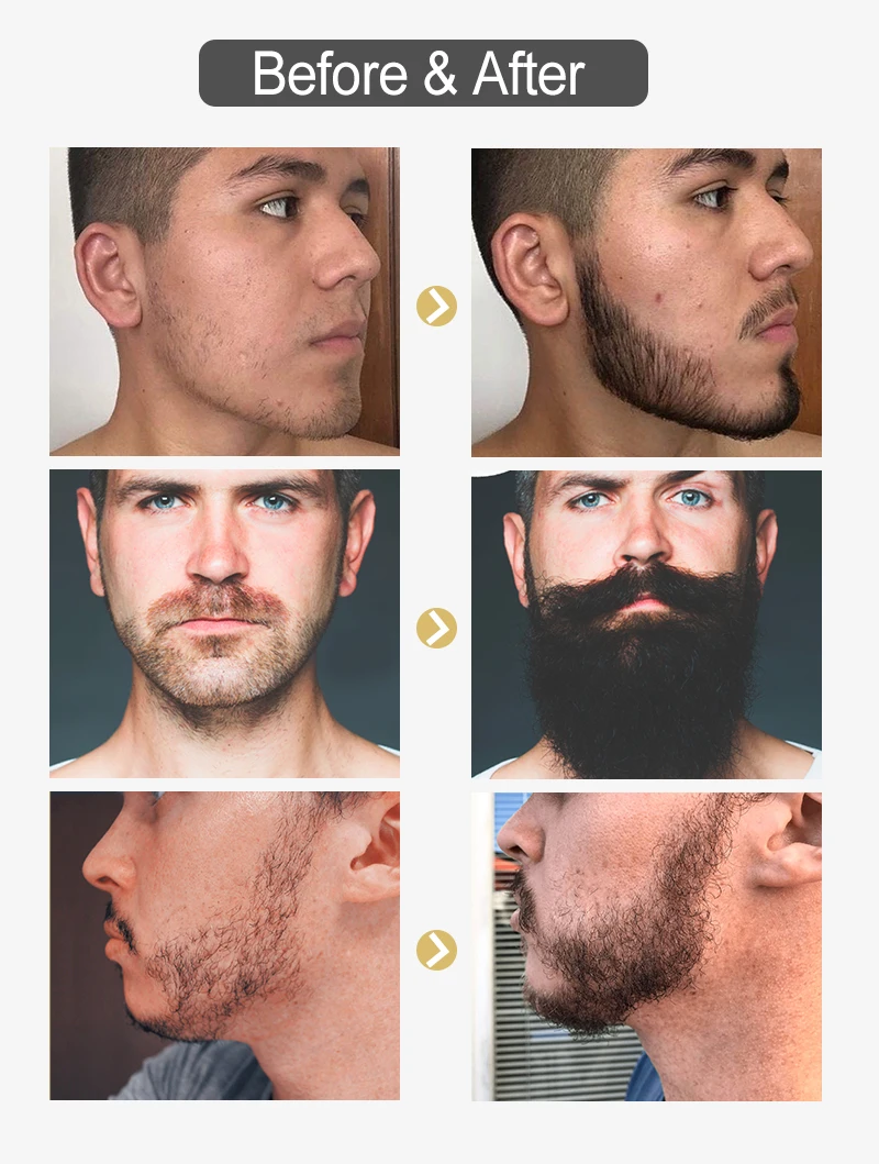 Purc Beard Growth Man Hair Sprays Essential Natural Hair Loss Products  Nourishing Enhancer Hair Eyebrow Beard Care Beauty Health - Hair Loss  Product Series - AliExpress