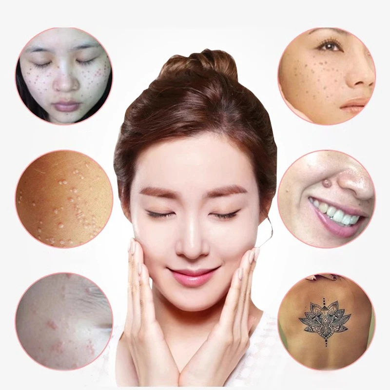 220V Electronic Spot Scanner Dead Skin Removal Beauty Device Remove Dark Mole Face Cleaner Skincare Tools Blackhead Remover