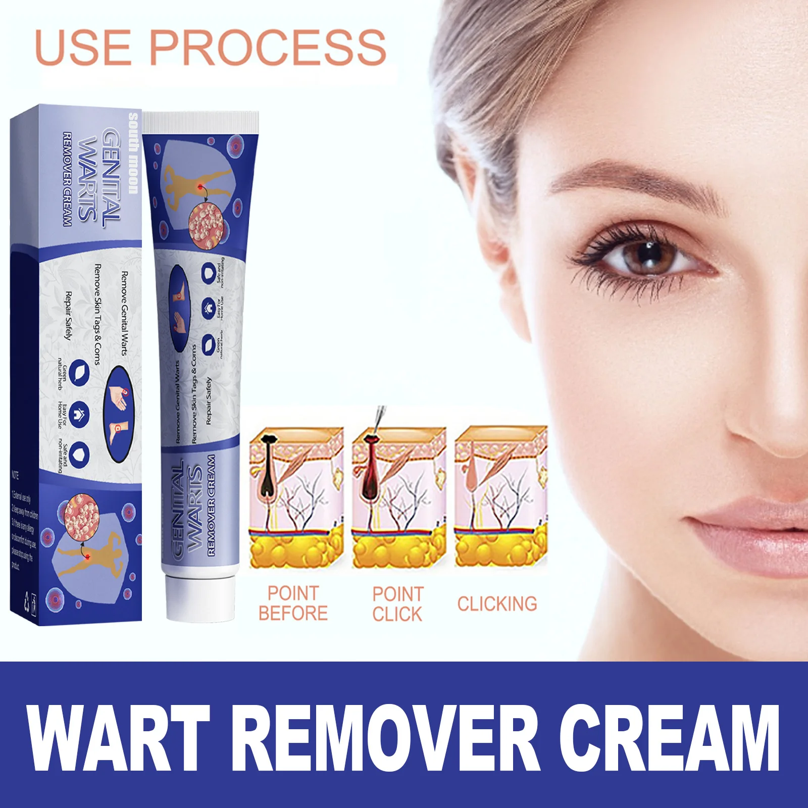 

Wart Remove ointment Warts Removing liquid wart fiat Treatment Armpit Flat Wart Genitals Feet Corns Medical Antibacterial cream